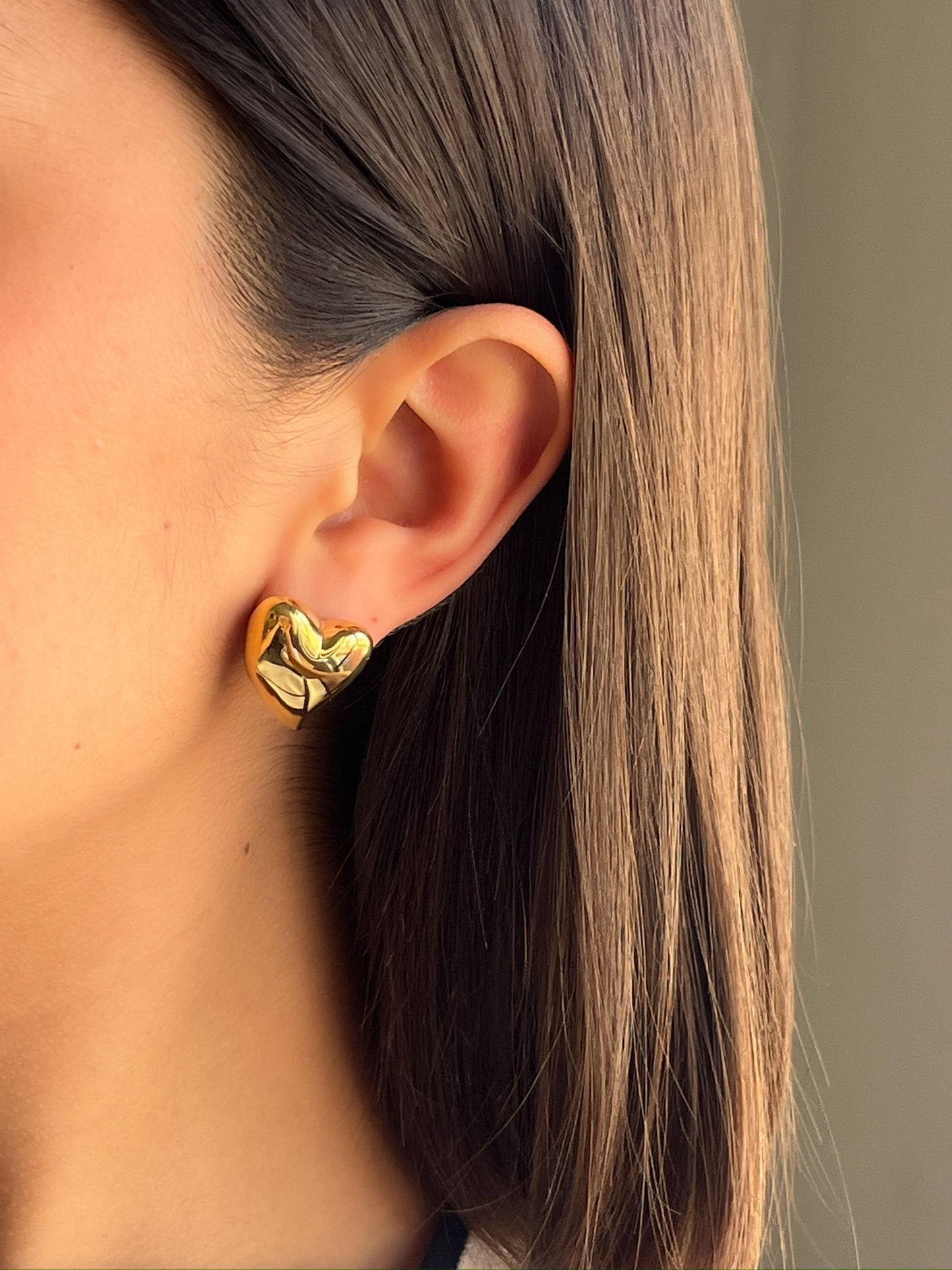Arete Amore