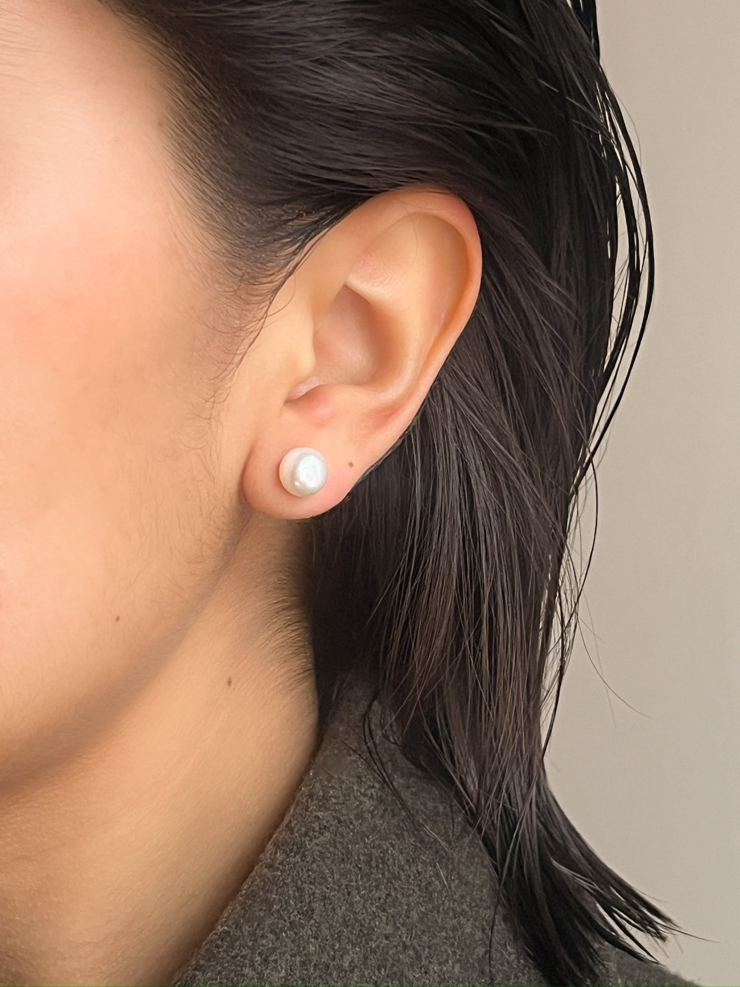 Arete Charme